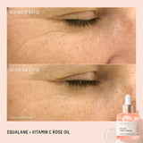 Biossance Squalane + Vitamin C Rose Firming Oil (2 sizes)